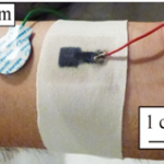 Textile electrodes for electrocardiography