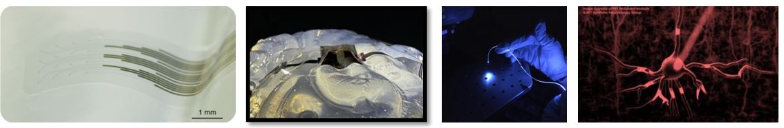 Implantable neurotechnologies