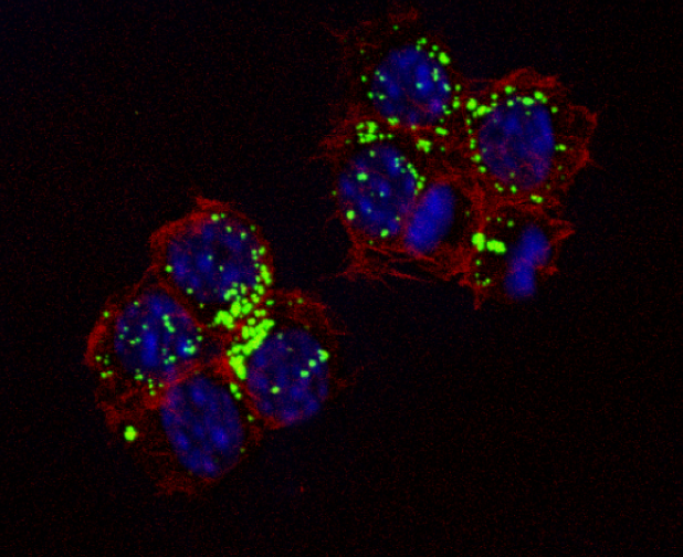 Activité des macrophages lors de l'internalisation de particules inhalées.